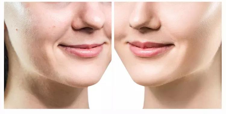 1666716324982885.jpg bcb3f4c3c54d74294d0f6de9d95fa74.jpg