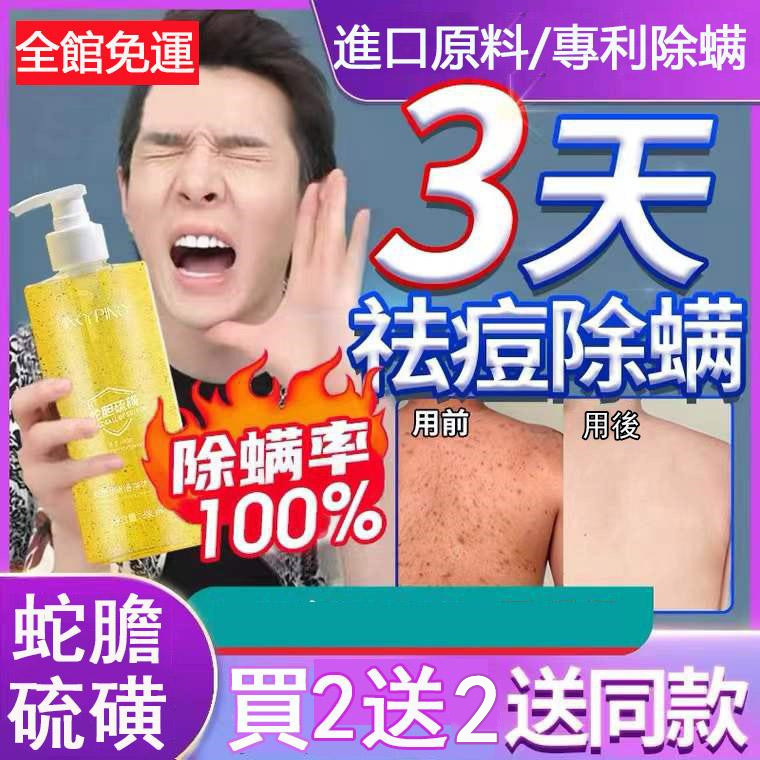 【日本專利配方】【蛇膽硫磺除螨沐浴乳】蛇膽精華 水感養膚還你水嫩肌膚!男女都適用,全身可用!